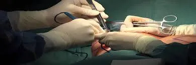 Équipe de chirurgie spécialisée bomoyimalamu – Bomoyi Malamu