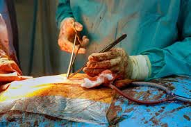 Salle d'opération – Chirurgie générale à Brazzaville