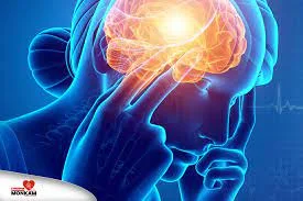 Prise en charge AVC et urgences neurologiques – Bomoyi Malamu